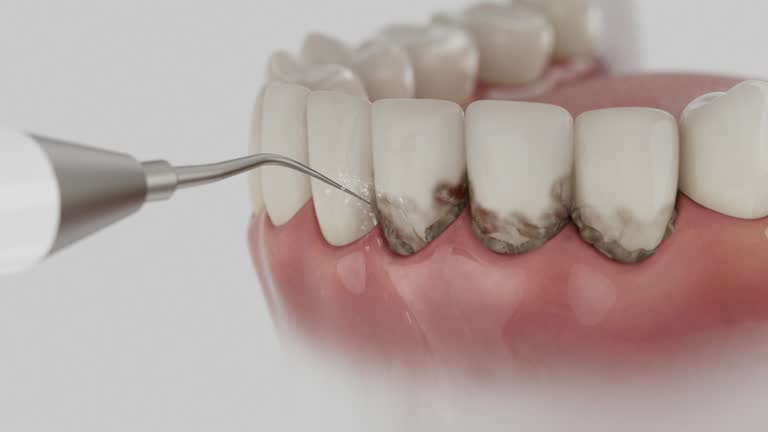 Reliable Dental Implants contractor in Pittsburg County County, OK by Dentist Open Now